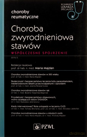 Choroba zwyrodnieniowa stawów [KSIĄŻKA]