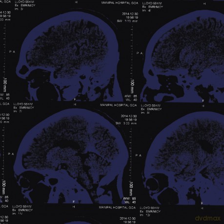 Nightingales: Mind Over Matter [CD]