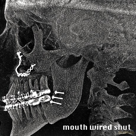Mouth Wired Shut: Mouth Wired Shut [CD]