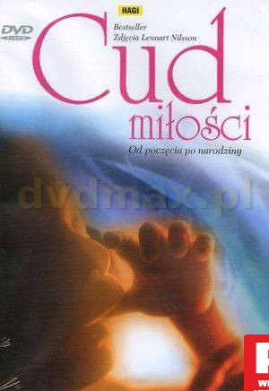 Cud miłości [DVD]