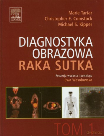 Diagnostyka obrazowa raka sutka (Tom 1) [KSIĄŻKA]