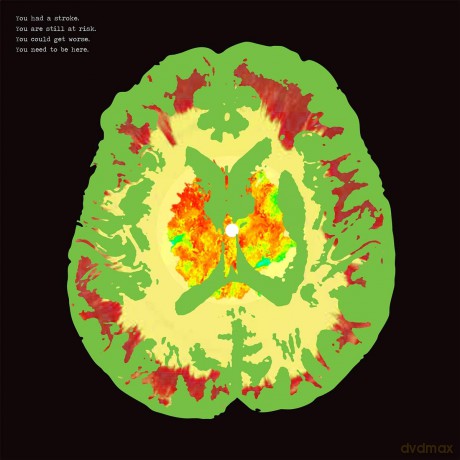 Minus 5: Stroke Manor (RSD 2019) [CD]
