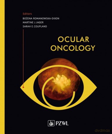 Ocular oncology - Bożena Romanowska-Dixon [KSIĄŻKA]
