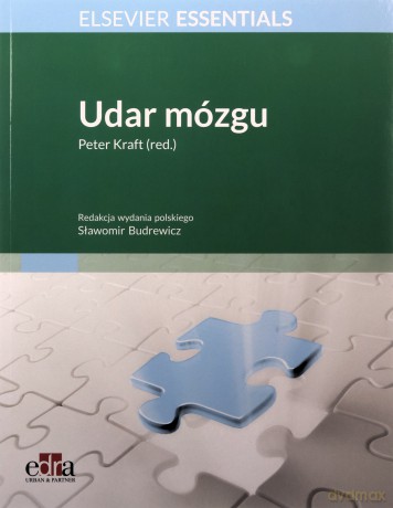 Udar mózgu [KSIĄŻKA]