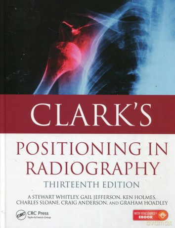 Clarks Positioning in radiography - Stewart Whitley, Gail Jefferson [KSIĄŻKA]