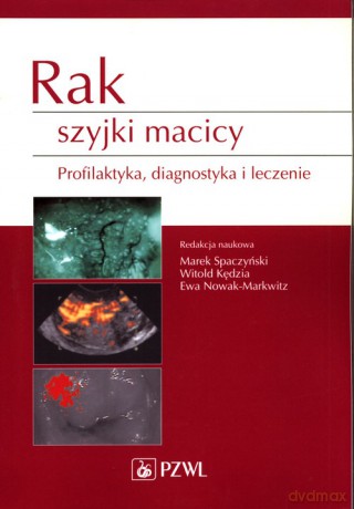 Rak szyjki macicy [KSIĄŻKA]