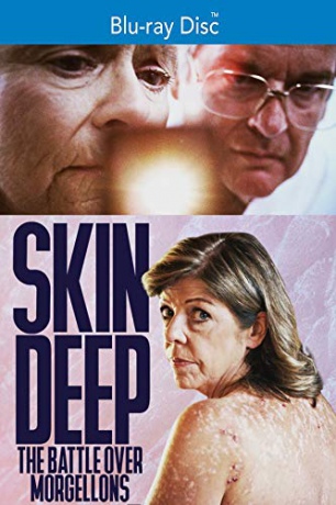 Skin Deep: The Battle Over Morgellons [Blu-Ray]