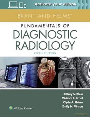 Brant and Helms' Fundamentals of Diagnostic Radiology [KSIĄŻKA]