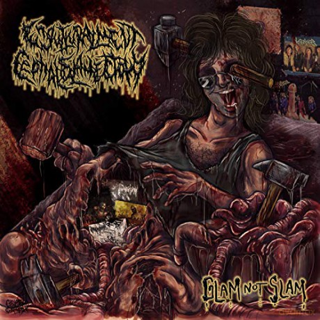 Engutturalment Cephaloslamectomy: Ephaloslamectomy [CD]