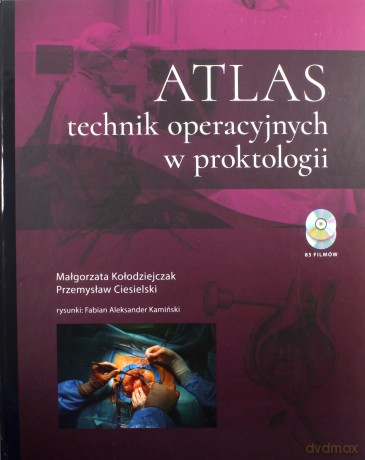 Atlas technik operacyjnych w proktologii - Małgorzata Kołodziejczak, Przemysław Ciesielski [KSIĄŻKA]