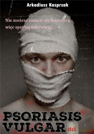 Psoriasis Vulgarna - Arkadiusz Kasprzak [KSIĄŻKA]