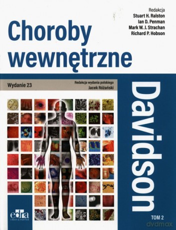 Davidson Choroby wewnętrzne (Tom 2) - H. Ralston Stuart, W.J. Strachan Mark [KSIĄŻKA]