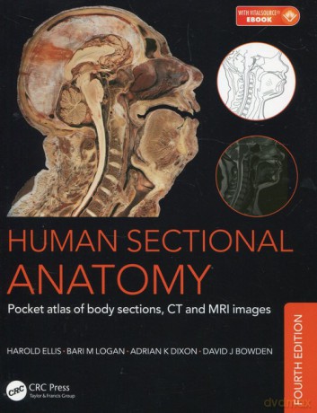 Human Sectional Anatomy - Harold Ellis, M. Logan Bari [KSIĄŻKA]