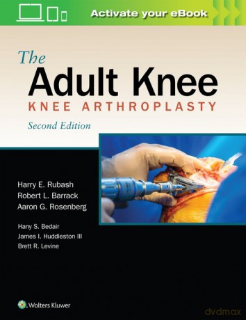 The Adult Knee Second edition - Harry E. Rubash [KSIĄŻKA]