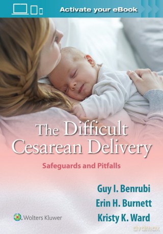 The Difficult Cesarean Delivery: Safeguards and Pitfalls - Guy I. Benrubi [KSIĄŻKA]