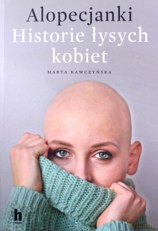 Alopecjanki. Historie łysych kobiet - Marta Kawczyńska [KSIĄŻKA]