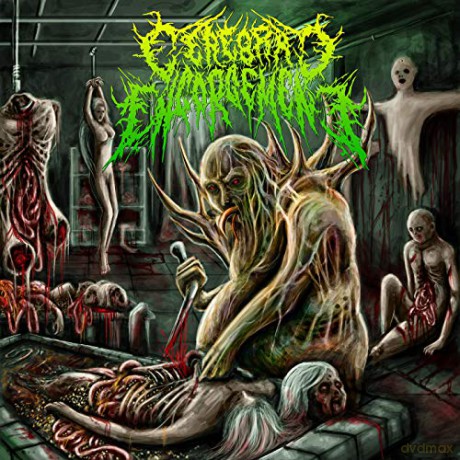 Cerebral Engorgement: Gastrointestinal Bleeding [CD]