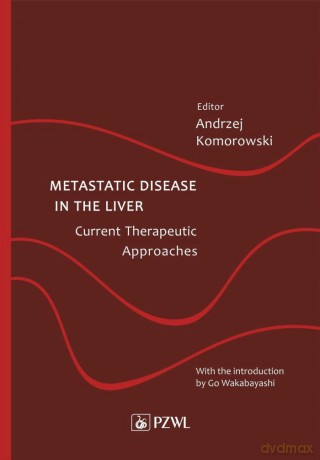 Metastatic Disease in the Liver - Current Therapeutic Approaches - Andrzej Komorowski [KSIĄŻKA]