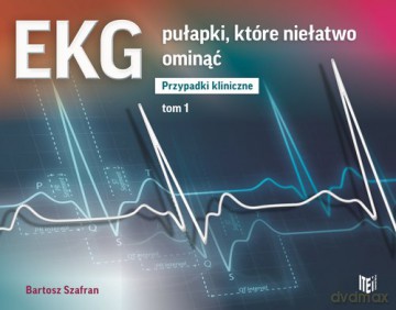 EKG pułapki, które niełatwo ominąć Przypadki kliniczne (Tom 1) - Bartosz Szafran [KSIĄŻKA]