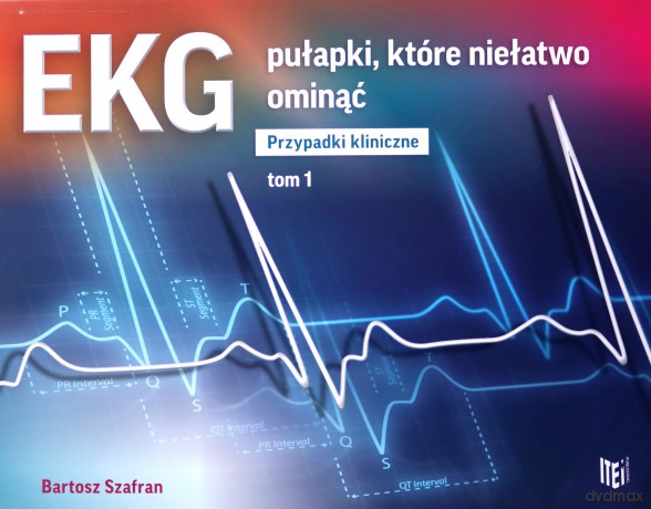 EKG pułapki, które niełatwo ominąć Przypadki kliniczne (Tom 1) - Bartosz Szafran [KSIĄŻKA]