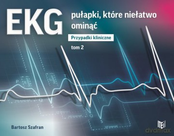 EKG pułapki, które niełatwo ominąć Przypadki kliniczne (Tom 2) - Bartosz Szafran [KSIĄŻKA]