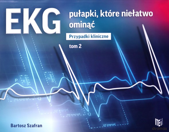 EKG pułapki, które niełatwo ominąć Przypadki kliniczne (Tom 2) - Bartosz Szafran [KSIĄŻKA]