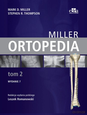 Ortopedia Miller (Tom 2) - Miller M.D., Thompson S.R. [KSIĄŻKA]