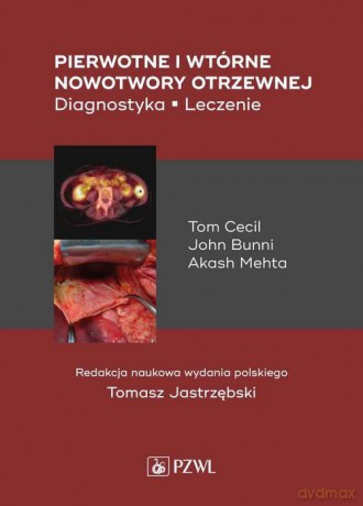 Pierwotne i wtórne nowotwory otrzewnej - Tom Cecil, John Bunni [KSIĄŻKA]