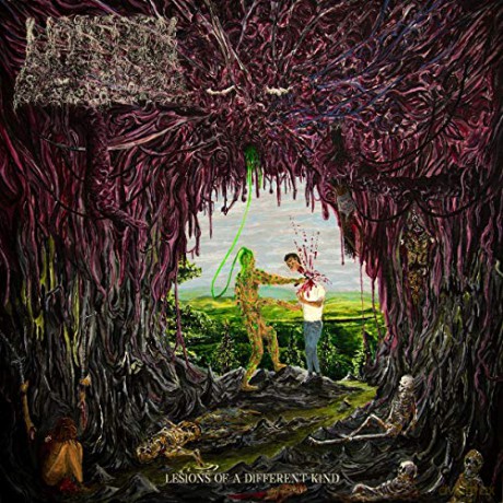 Undeath: Lesions Of A Different Kind [CD]