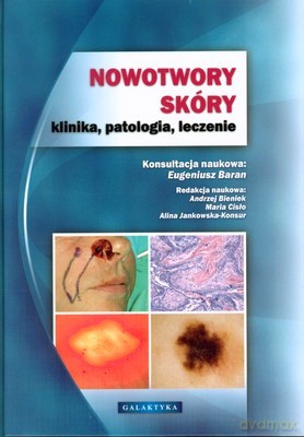 Nowotwory Skóry Klinika Patologia Leczenie (twarda) [KSIĄŻKA]