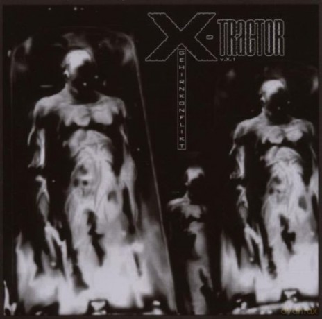 X-Tractor: Gehirnkonflikt [CD]