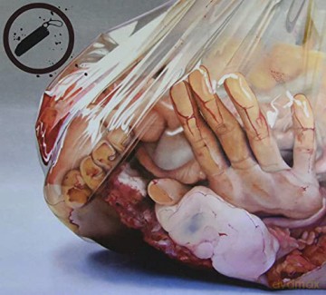 Atropine: Human Emulsion [2CD]