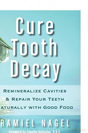 Cure Tooth Decay: Remineralize Cavities and Repair Your Teeth Naturally with Good Food - Ramiel Nagel [KSIĄŻKA]