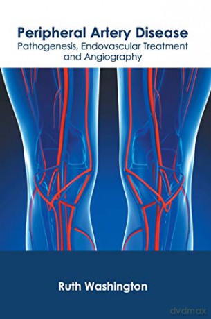 Peripheral Artery Disease: Pathogenesis, Endovascular Treatment and Angiography - Ruth Washington [KSIĄŻKA]