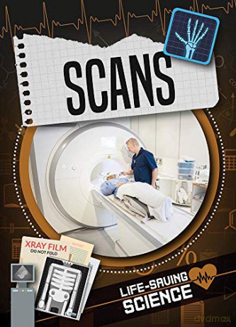 Scans (Life-Saving Science) - Joanna Brundle [KSIĄŻKA]