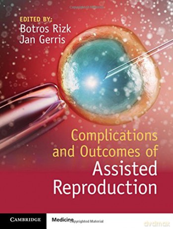 Complications and Outcomes of Assisted Reproduction - Botros Rizk [KSIĄŻKA]
