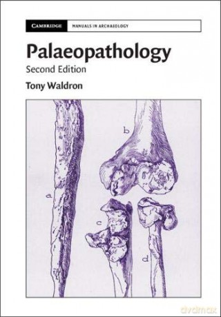 Palaeopathology (Cambridge Manuals in Archaeology) - Tony Waldron [KSIĄŻKA]