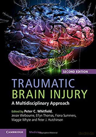 Traumatic Brain Injury: A Multidisciplinary Approach - Peter C. Whitfield [KSIĄŻKA]