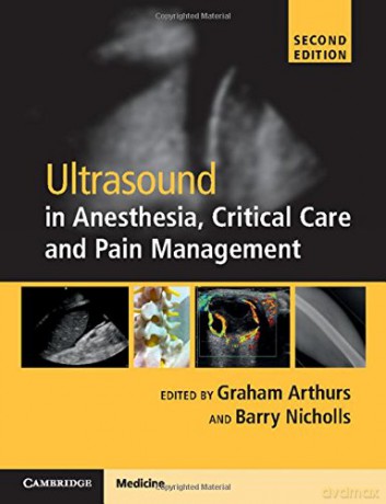 Ultrasound in Anesthesia, Critical Care and Pain Management with Online Resource - Graham Arthurs [KSIĄŻKA]