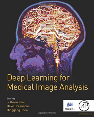 Deep Learning for Medical Image Analysis (The MICCAI Society book Series) [KSIĄŻKA]