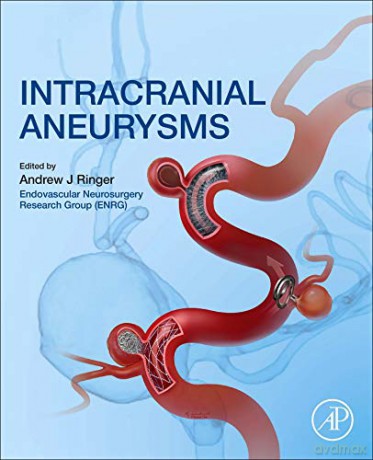 Intracranial Aneurysms - Andrew J. Ringer [KSIĄŻKA]
