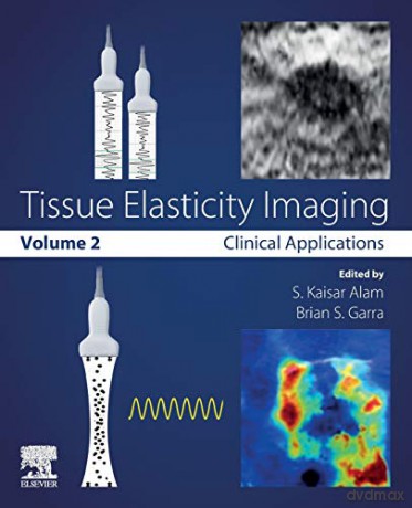 Tissue Elasticity Imaging: Volume 2: Clinical Applications - S. Kaisar Alam [KSIĄŻKA]