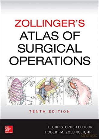 Zollinger's Atlas of Surgical Operations, Tenth Edition - Robert Zollinger [KSIĄŻKA]