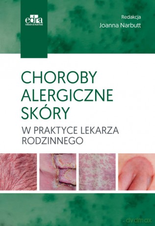 Choroby alergiczne skóry w praktyce lekarza rodzinnego [KSIĄŻKA]