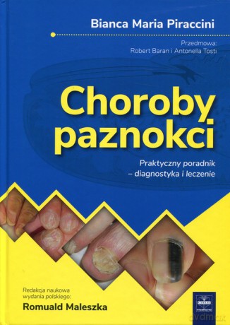 Choroby paznokci Praktyczny poradnik - diagnostyka i leczenie - Bianca Maria Piraccini [KSIĄŻKA]