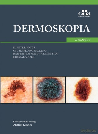 Dermoskopia - Soyer H.P., Argenziano G. [KSIĄŻKA]