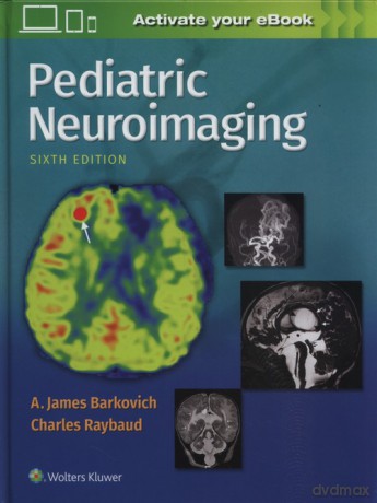 Pediatric Neuroimaging 6e - James Barkovich A., Charles Raybaud [KSIĄŻKA]