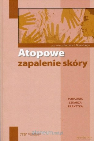 Atopowe zapalenie skóry. Poradnik lekarza praktyka [KSIĄŻKA]