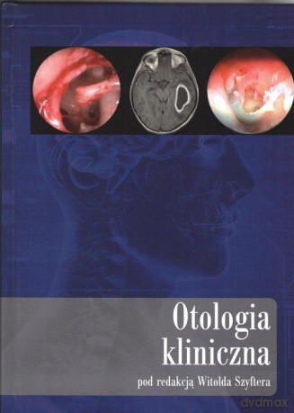 Otologia kliniczna [KSIĄŻKA]