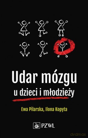 Udar mózgu u dzieci i młodzieży - Ewa Pilarska, Ilona Kopyta [KSIĄŻKA]
